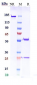 Anti-Complement C5 Reference Antibody (pozelimab)